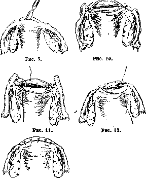 Fallopian Tubes: figure 9 from the 1928–1936 encyclopedia article
