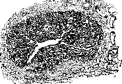 Fallopian Tubes: figure 2 from the 1928–1936 encyclopedia article