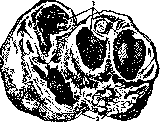 Fallopian Tubes: figure 5 from the 1928–1936 encyclopedia article