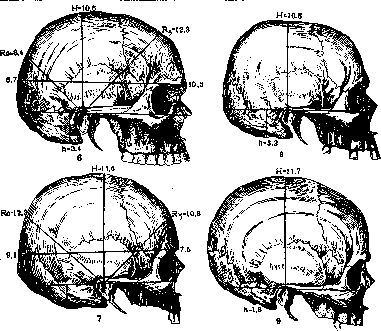 Cerebro-Cranial Topography: figure 4 from the 1928–1936 encyclopedia article