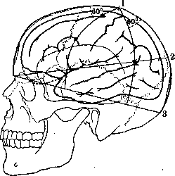 Cerebro-Cranial Topography: figure 6 from the 1928–1936 encyclopedia article