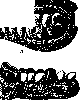DENTAL PROSTHESES: figure 3 from the 1928–1936 encyclopedia article