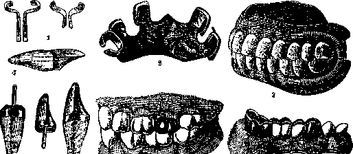 DENTAL PROSTHESES: figure 1 from the 1928–1936 encyclopedia article