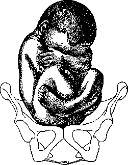 Fetal Position Anomalies: figure 2 from the 1928–1936 encyclopedia article