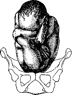 Fetal Position Anomalies: figure 1 from the 1928–1936 encyclopedia article
