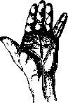 Panaritium: figure 3 from the 1928–1936 encyclopedia article