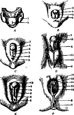 Hermaphroditism: figure 7 from the 1928–1936 encyclopedia article