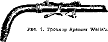 Ovariotomy: figure 1 from the 1928–1936 encyclopedia article