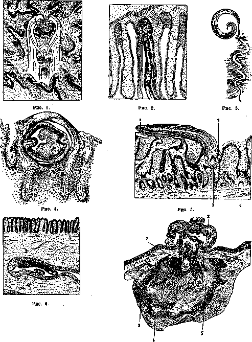 Human Helminthiases: figure 1 from the 1928–1936 encyclopedia article