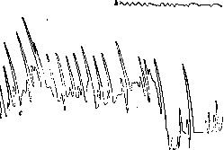 Newborn: figure 1 from the 1928–1936 encyclopedia article