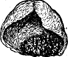 Placenta: figure 9 from the 1928–1936 encyclopedia article