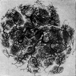 Placenta: figure 5 from the 1928–1936 encyclopedia article