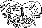 Gowers' Tract: figure 1 from the 1928–1936 encyclopedia article