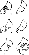 Stomach: figure 33 from the 1928–1936 encyclopedia article