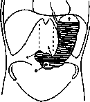 Stomach: figure 6 from the 1928–1936 encyclopedia article