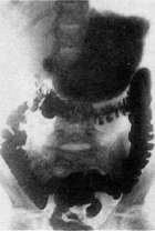 Stomach: figure 24 from the 1928–1936 encyclopedia article