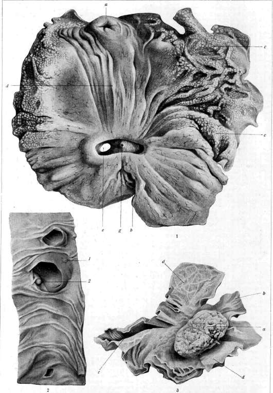 Stomach: figure 32 from the 1928–1936 encyclopedia article