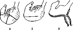Stomach: figure 20 from the 1928–1936 encyclopedia article