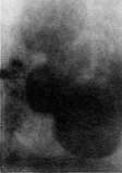 Stomach: figure 28 from the 1928–1936 encyclopedia article