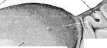 Dermographism: figure 7 from the 1928–1936 encyclopedia article