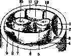 Preoperative Period: figure 1 from the 1928–1936 encyclopedia article