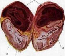 Gastroscopy: figure 8 from the 1928–1936 encyclopedia article