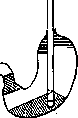 Gastroscopy: figure 3 from the 1928–1936 encyclopedia article