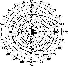 Scotoma: figure 8 from the 1928–1936 encyclopedia article