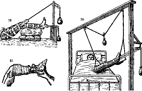 Fume Hood: figure 1 from the 1928–1936 encyclopedia article