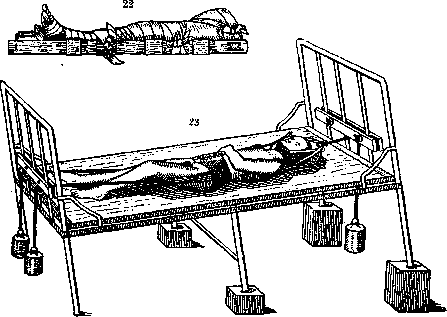 Fume Hood: figure 2 from the 1928–1936 encyclopedia article