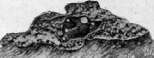 Pulmonary Tuberculosis: figure 4 from the 1928–1936 encyclopedia article