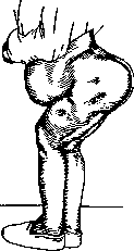 Lordosis: figure 6 from the 1928–1936 encyclopedia article