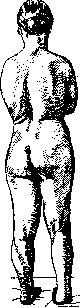 Lordosis: figure 5 from the 1928–1936 encyclopedia article
