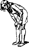 Dystrophy: figure 3 from the 1928–1936 encyclopedia article
