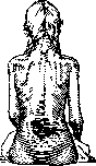 Dystrophy: figure 7 from the 1928–1936 encyclopedia article
