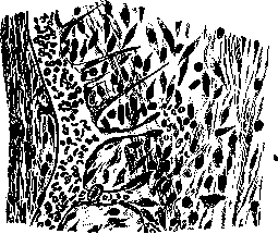 Wounds: figure 1 from the 1928–1936 encyclopedia article