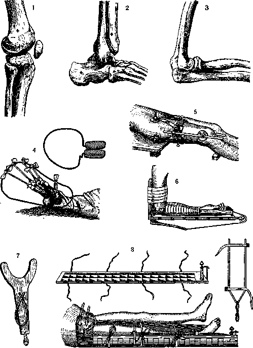 Traction: figure 1 from the 1928–1936 encyclopedia article