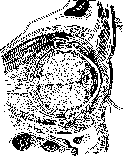 Tenon's Capsule: figure 1 from the 1928–1936 encyclopedia article