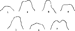 Palatine Bone: figure 8 from the 1928–1936 encyclopedia article
