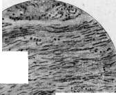Lungs: figure 27 from the 1928–1936 encyclopedia article
