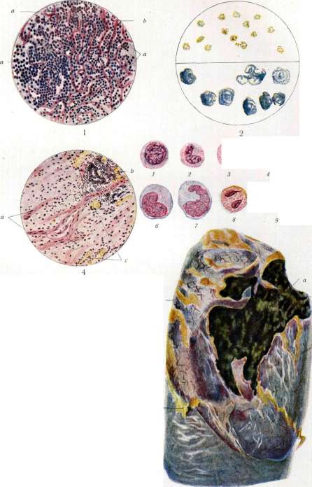 Lungs: figure 30 from the 1928–1936 encyclopedia article