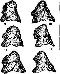 Lungs: figure 19 from the 1928–1936 encyclopedia article