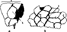 Lungs: figure 23 from the 1928–1936 encyclopedia article