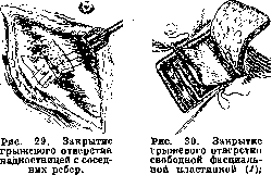Lungs: figure 35 from the 1928–1936 encyclopedia article