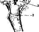 Lungs: figure 24 from the 1928–1936 encyclopedia article
