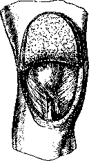 Dislocations: figure 18 from the 1928–1936 encyclopedia article