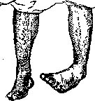 Dislocations: figure 19 from the 1928–1936 encyclopedia article