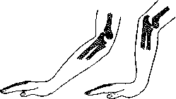 Dislocations: figure 5 from the 1928–1936 encyclopedia article