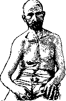 Dislocations: figure 1 from the 1928–1936 encyclopedia article