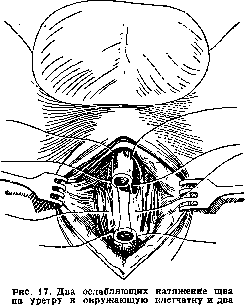 Urethra: figure 16 from the 1928–1936 encyclopedia article